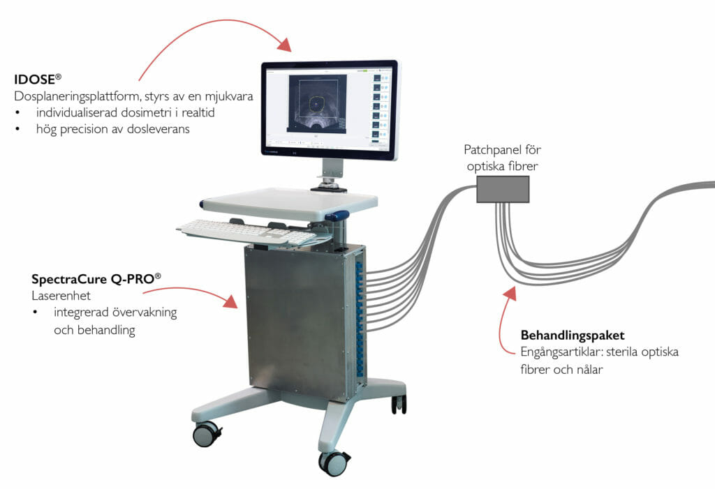 Ny Behandling Av Prostatacancer Interstitiell Fotodynamisk Terapi 